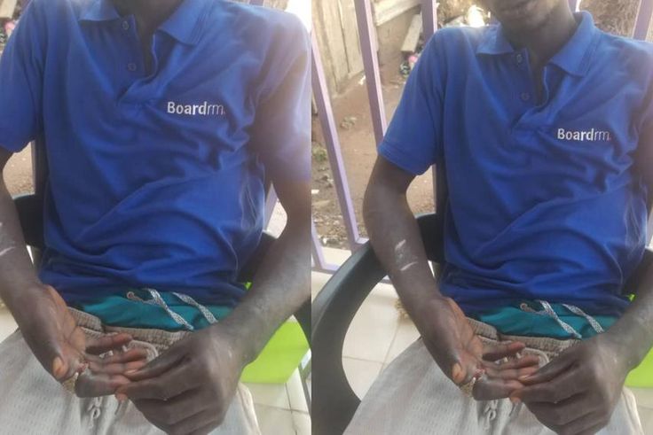 Pantang teenager's index finger rots away after wearing stolen ‘spiritual’ ring