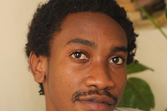 It's not uncommon for men to find their hairline receding