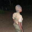 NYSC member Ezeiruaku Ifenyinwa Fidelia after she was beaten by a soldier in Calabar (Agba Jalingo)