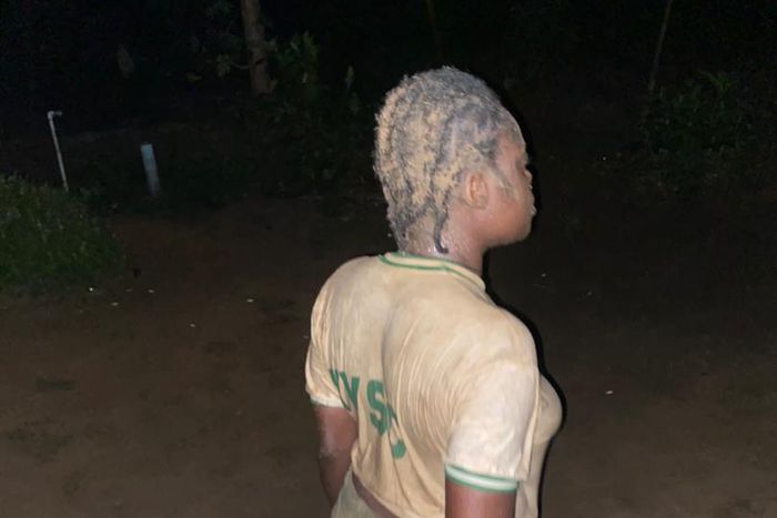 NYSC member Ezeiruaku Ifenyinwa Fidelia after she was beaten by a soldier in Calabar (Agba Jalingo)