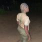 NYSC member Ezeiruaku Ifenyinwa Fidelia after she was beaten by a soldier in Calabar (Agba Jalingo)