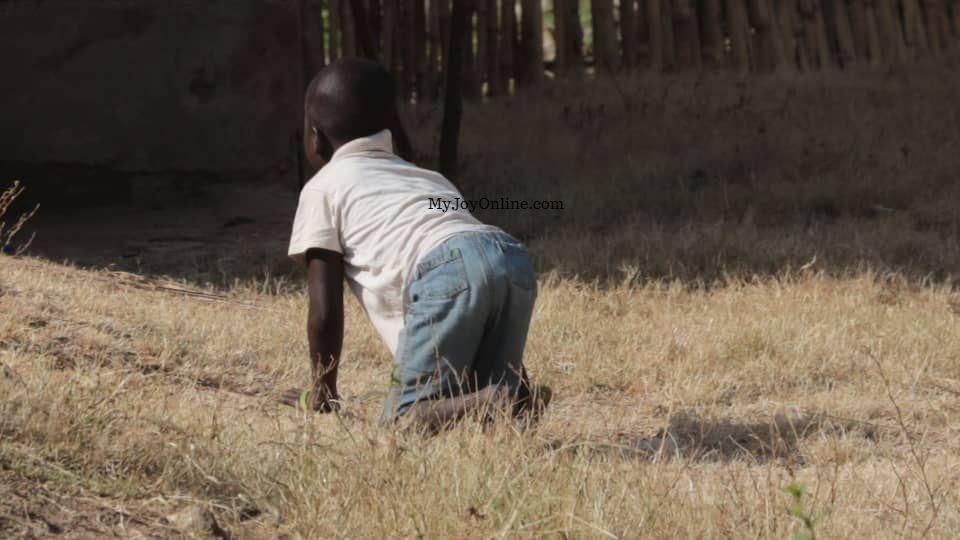 Mother calls for help to enable son who has lost his feet to walk again