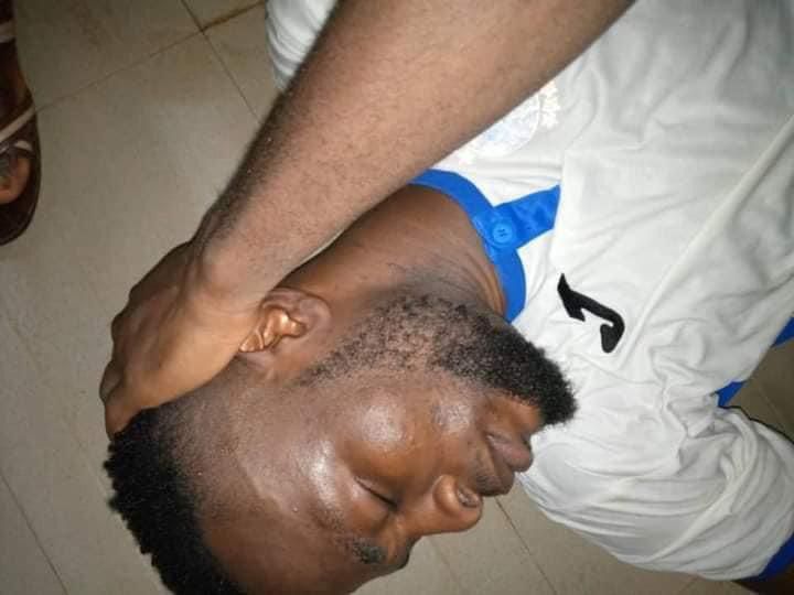 Enyimba players injured following attacks from fans after an NPFL game against Plateau United (Twitter/Coal_City)