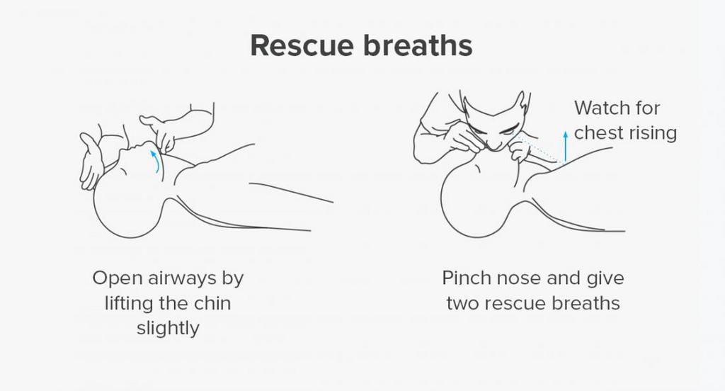 This is how to give rescue breaths {healthline}