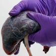 Stop eating placenta after childbirth, experts warn new mothers. [bbc]