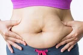 A woman's stomach after childbirth