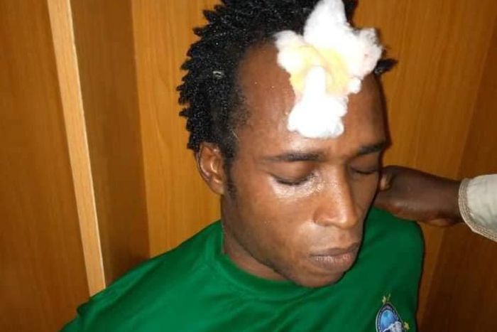 Enyimba players had to receive treatment after attacks from fans in Jos (Twitter/Coal__City)