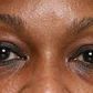 Dark eye circles are definitely not a good look [naturalandbrown]