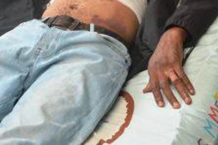 Man stabbed during #EndSARS memorial protest seeks Sanwo-Olu's assistance