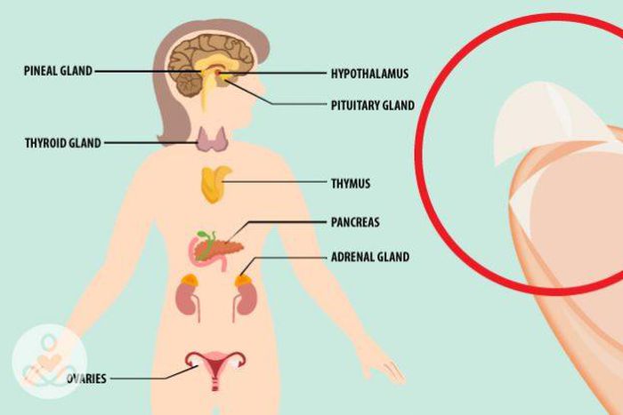 Hormonal imbalance(The Hearty Soul)
