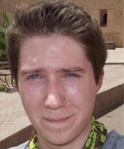 Oli London before surgey