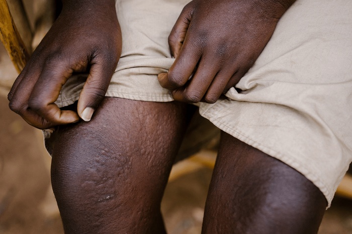 34-year-old Ghanaian teacher on the run after a sodomising 60-year-old man