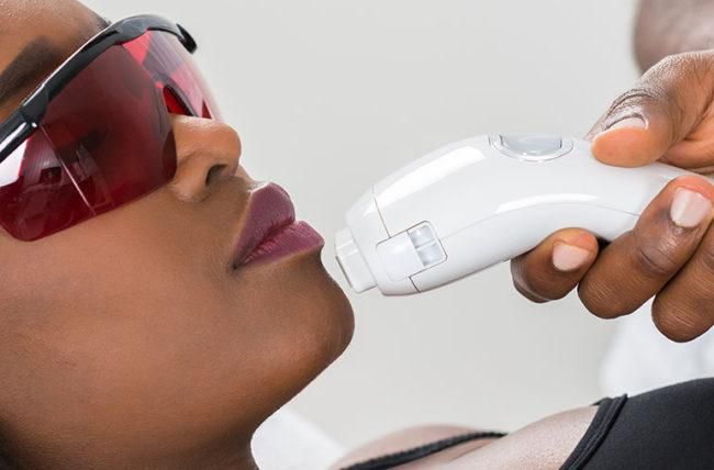 Laser hair removal can be used to remove hair from all the parts of the body [cleveland clinic]