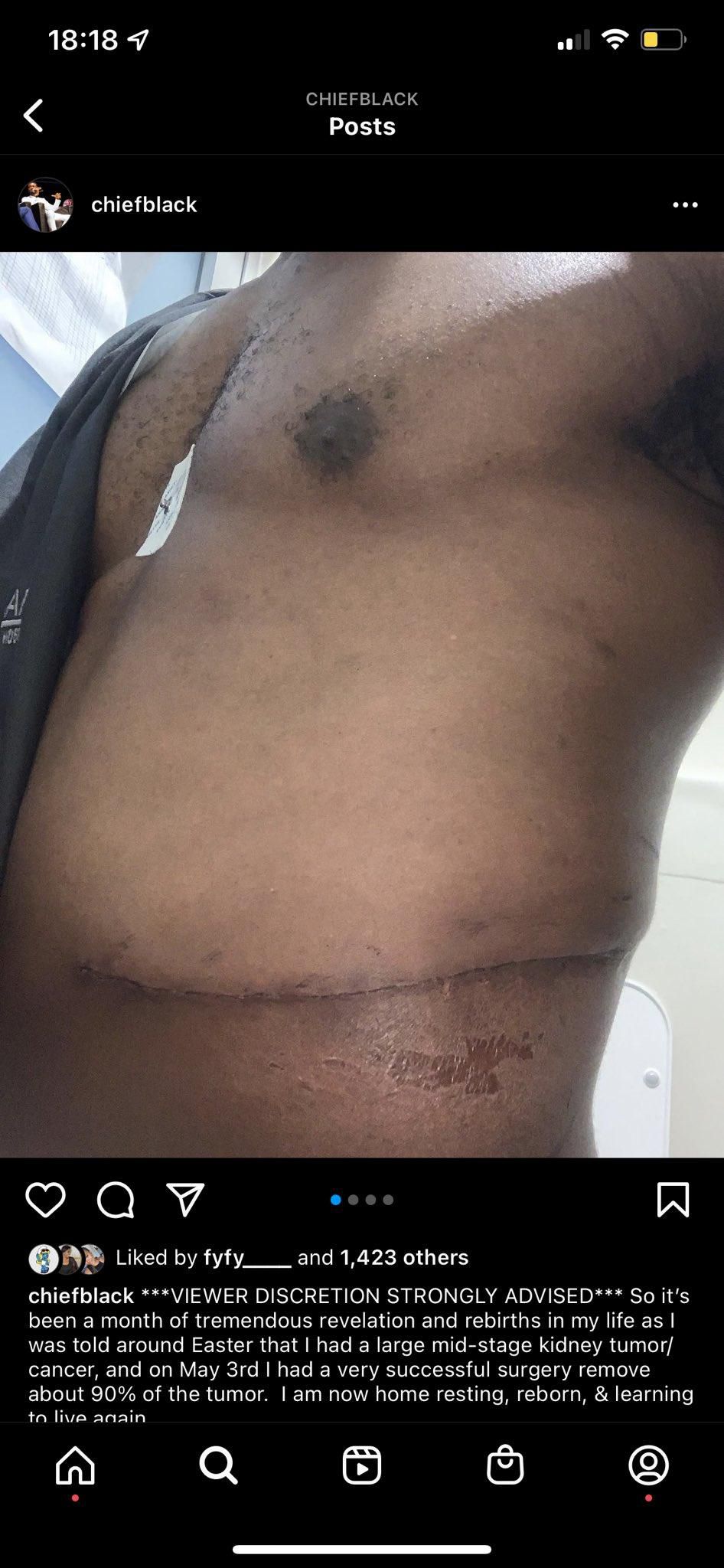 Karibi Fubara shared his battle with cancer [Instagram/chiefblack]