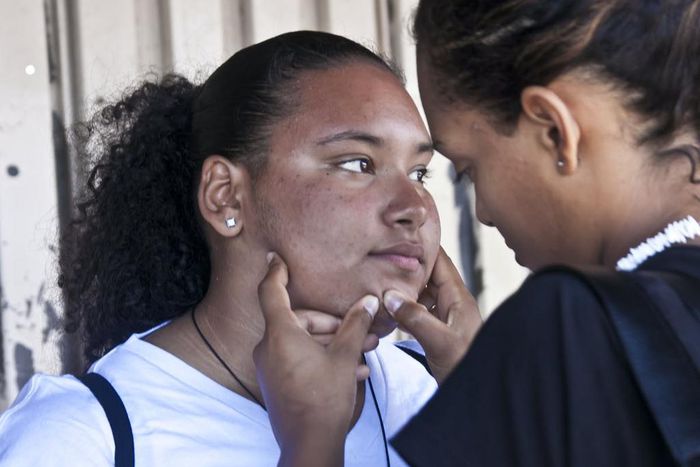 Popping your pimples is a temptation you need to resist [theconversation]