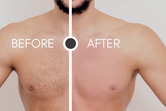 How to get rid of body hair [WaxFactor]