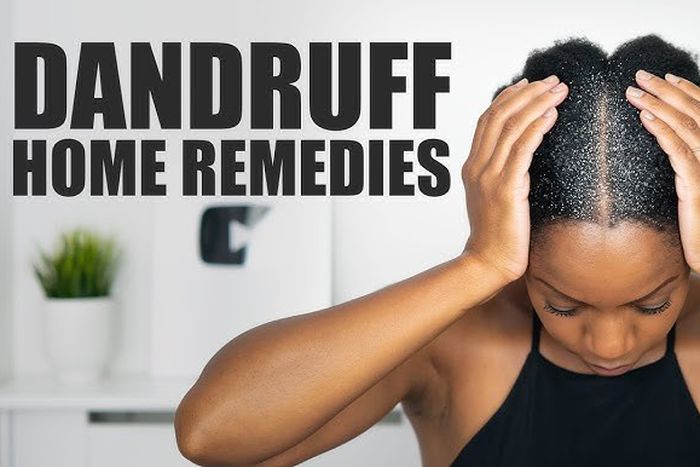 Home remedies for getting rid of dandruff [YouTube]
