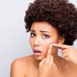 Caring for your skin can be challenging sometimes [iStock]