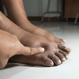 What causes feet swelling in pregnant women? [careplusfoot]
