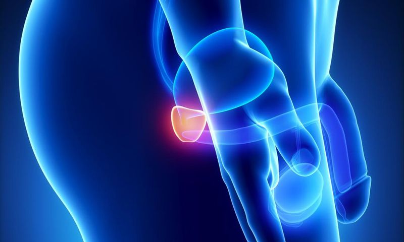 ___8347832___2018___5___7___10___prostate-cancer-is-the-most-common-cancer-affecting-men