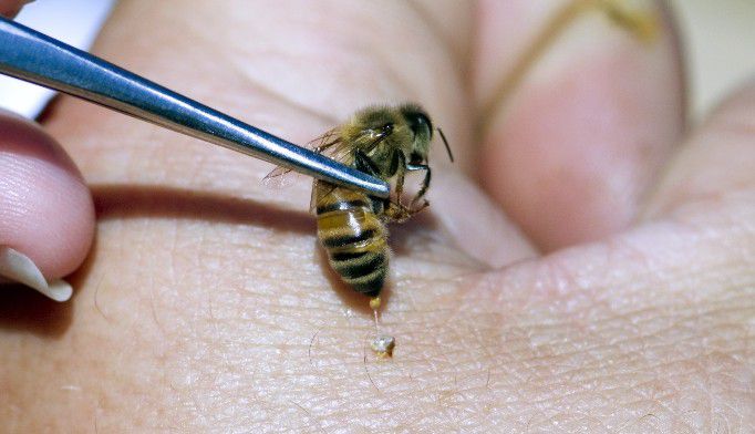 Bee venom treatments [ClinicalAdvisor]