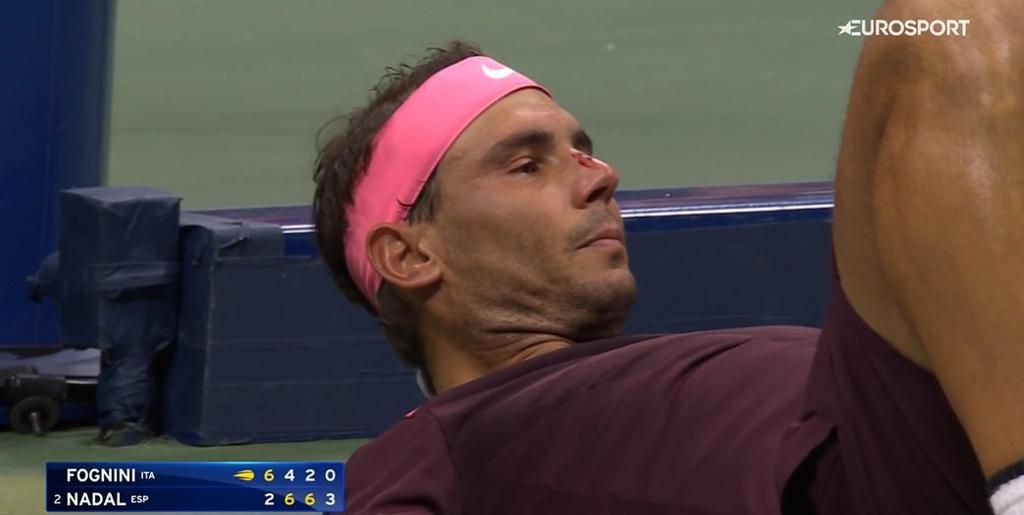 Nadal accidentally hit himself