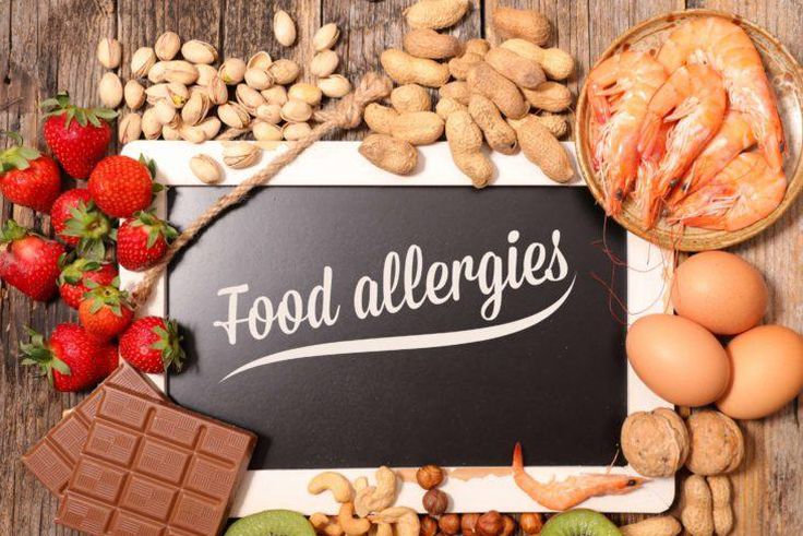 food allergies