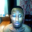 Mr 2Kay after the assault by robbers in his hotel room