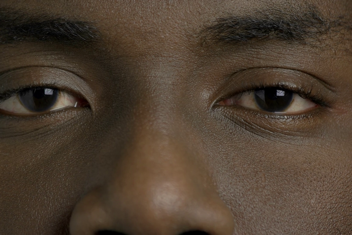 You can tell your cholesterol levels are high by looking at your eyes