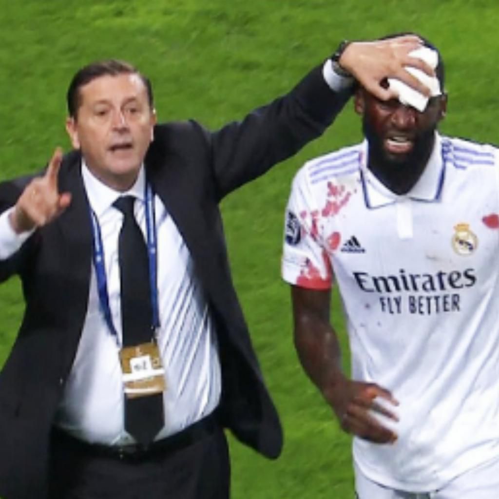 Rudiger sheds blood to rescue a point for Real Madrid against Shakhtar Donetsk