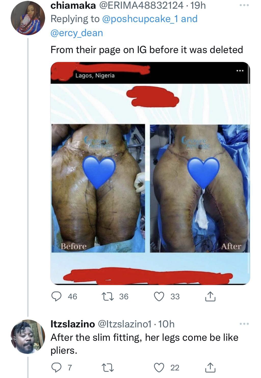 Twitter goes wild as Nigerian lady, Crystabel, dies through body enhancement surgery in Lagos