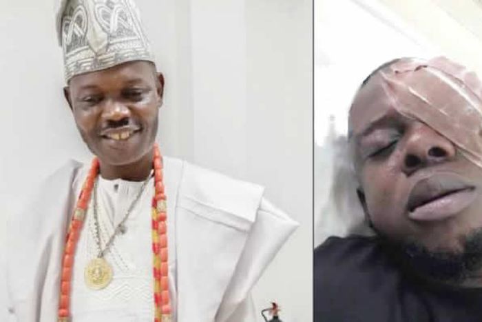 Trader calls out Ogun Monarch for blinding him