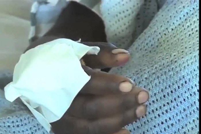 Peninah Wangeci's hand while in the hospital bed at Karatina Sub-county Hospital (Citizen)