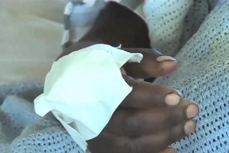 Peninah Wangeci's hand while in the hospital bed at Karatina Sub-county Hospital (Citizen)