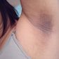 Dark underarm