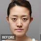 A South Korean lady before and after surgery [Koreaboo]