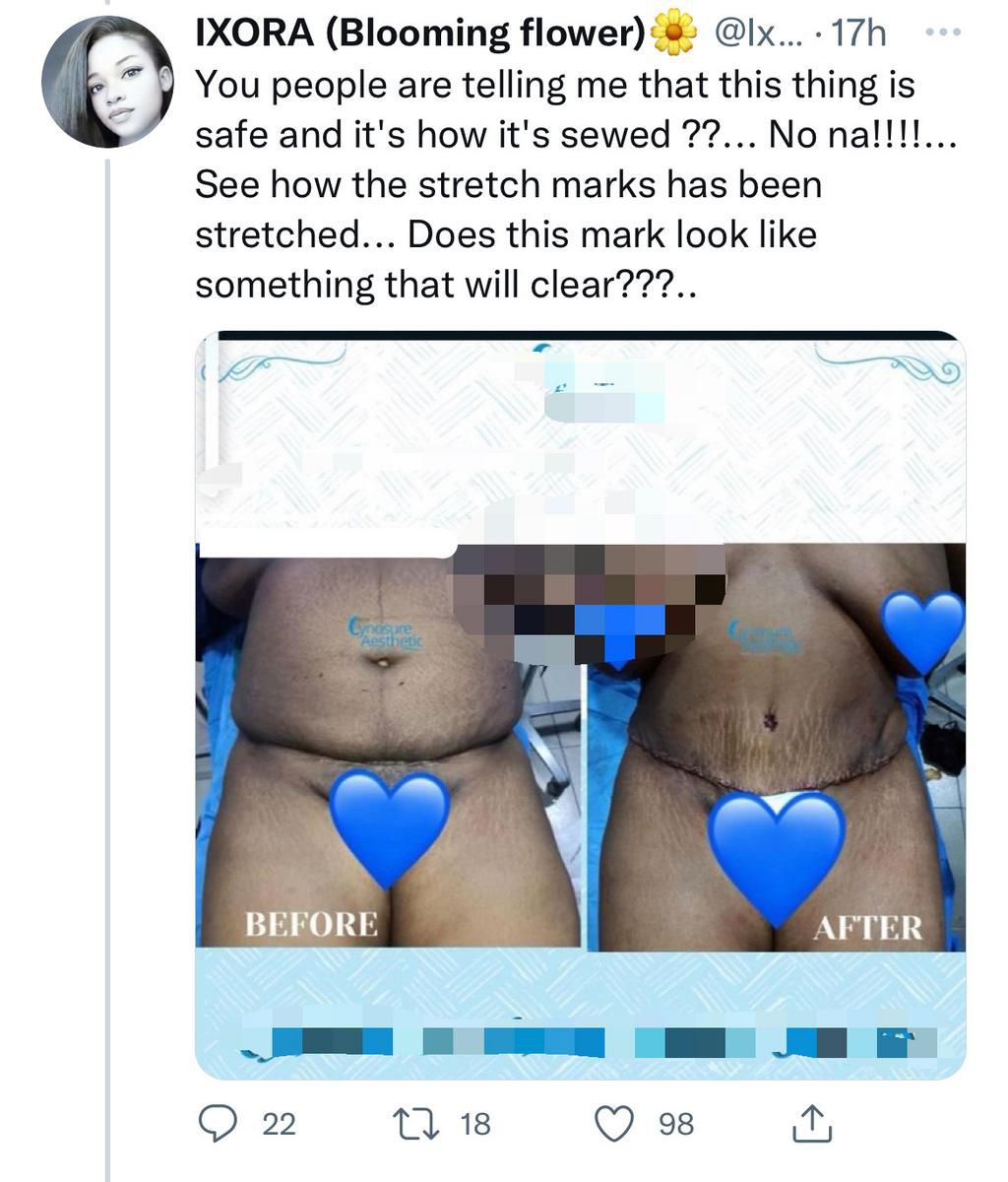 Twitter goes wild as Nigerian lady, Crystabel, dies through body enhancement surgery in Lagos
