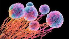 Cancer kills 41,000 people in Nigeria in 2018, says WHO