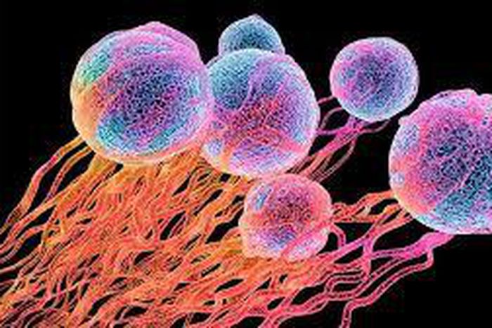 Cancer kills 41,000 people in Nigeria in 2018, says WHO