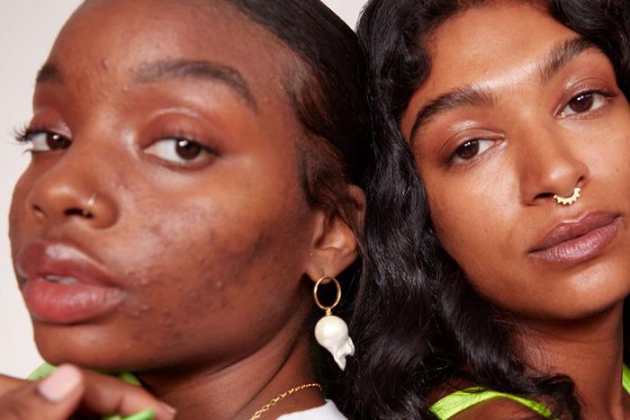 Acne can affect one's self esteem [teenvogue]