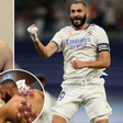 Karim Benzema