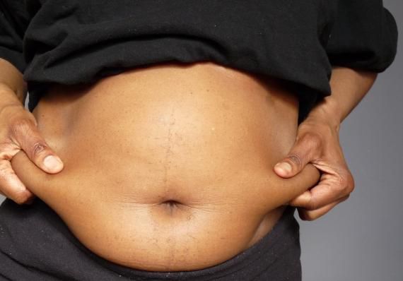 Belly fat might be unsexy to some women's husbands