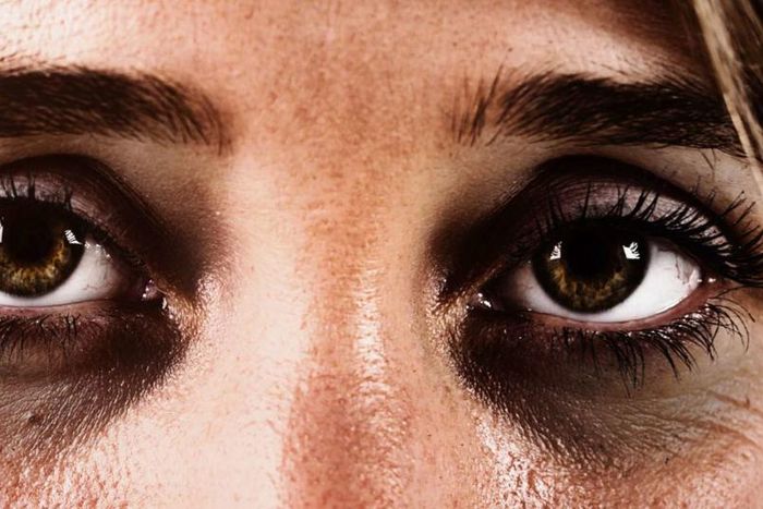 Try natural cures for wrinkles [Medicalnewstoday]