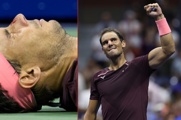 Rafael Nadal suffered a bloodied nose in his second round victory at US Open