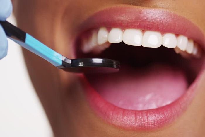 5 ways to naturally whiten your teeth at home