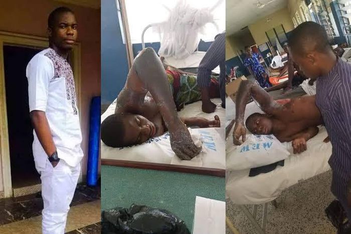 Tension in Akwa Ibom as petrol seller sets university student ablaze