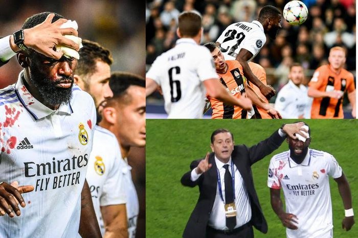 Rudiger sheds blood to rescue a point for Real Madrid against Shakhtar Donetsk