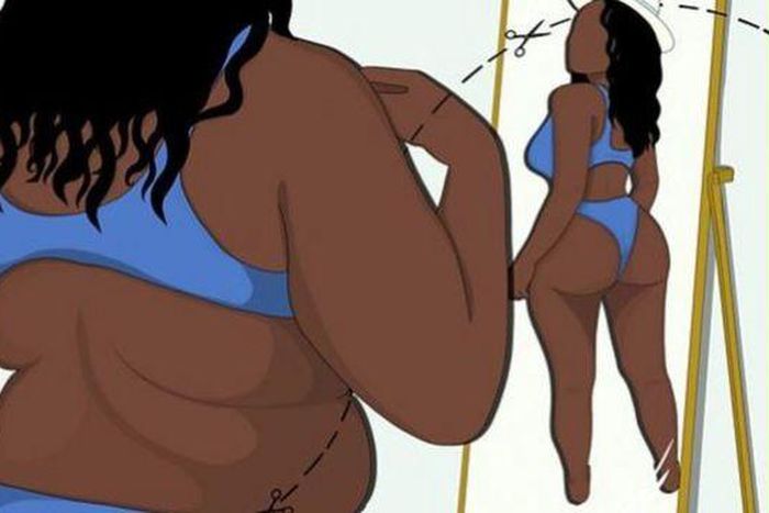 The Brazilian butt lift {bbc]