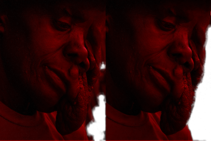 Safira, a woman with tumour