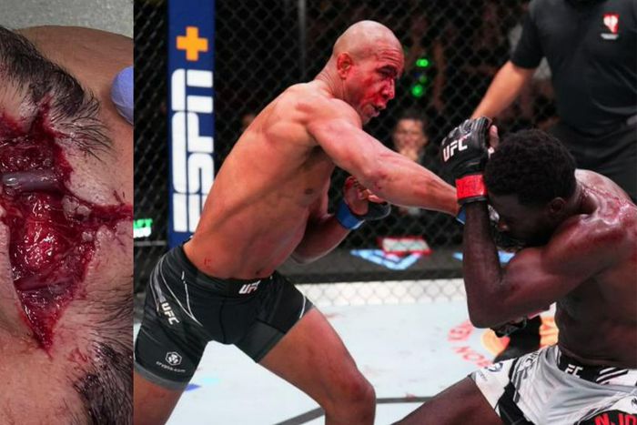 Nigeria's Chidi Njokuani stopped by Gregory Rodrigues